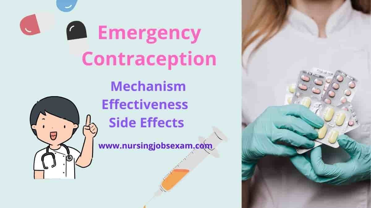 Emergency Contraception: Mechanism Effectiveness Side Effects By NJE ...