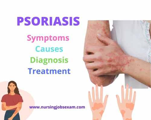 Psoriasis: Symptoms, Causes, Diagnosis, Treatment - Nursing Jobs Exam