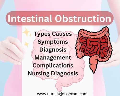 Intestinal Obstruction: Types, Causes, Symptoms, Diagnosis, Management ...